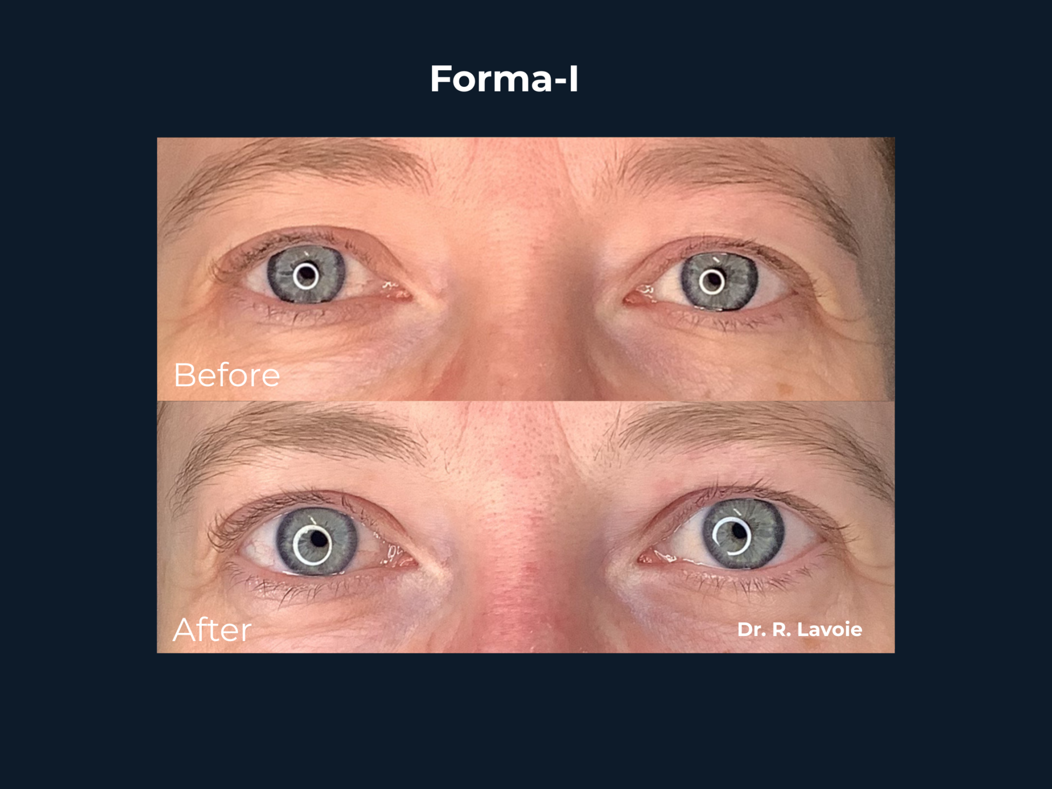 formai (1)
