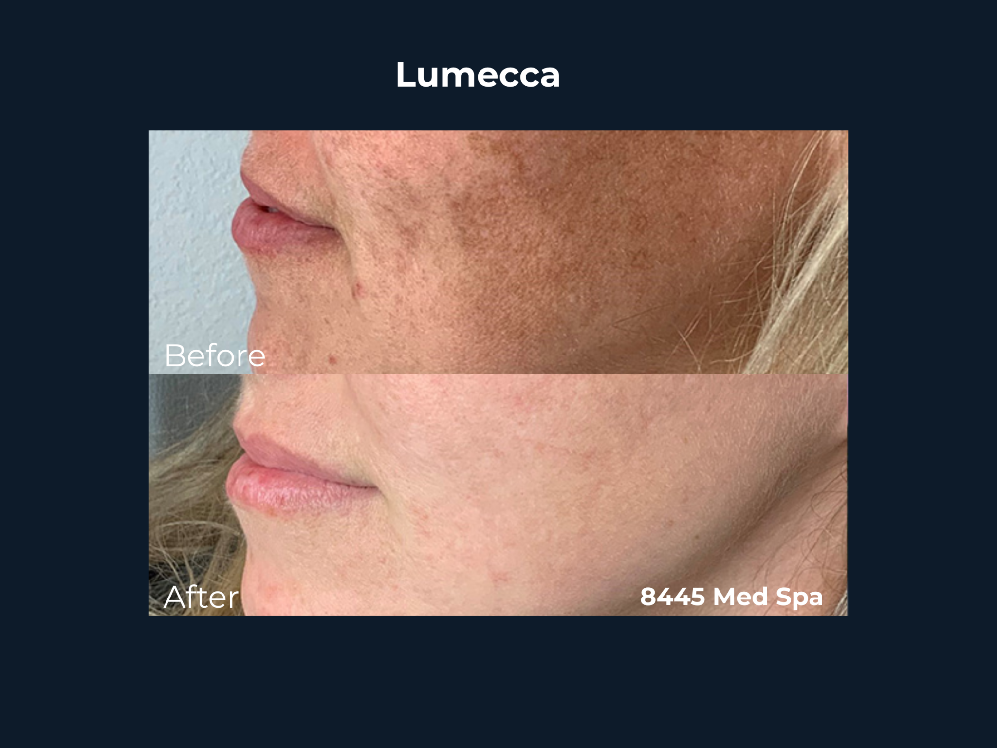 lumecca